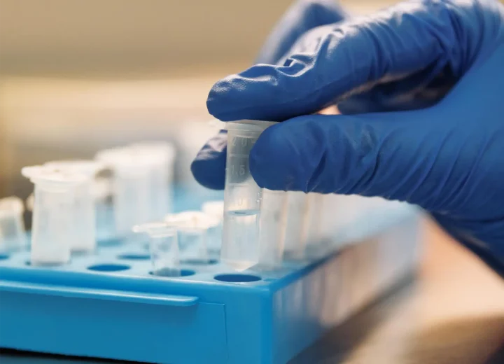 Mastering T4 DNA Ligase: protocols, buffers, and troubleshooting tips